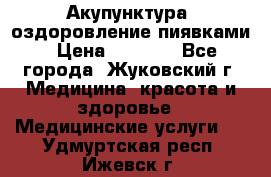 Акупунктура, оздоровление пиявками › Цена ­ 3 000 - Все города, Жуковский г. Медицина, красота и здоровье » Медицинские услуги   . Удмуртская респ.,Ижевск г.